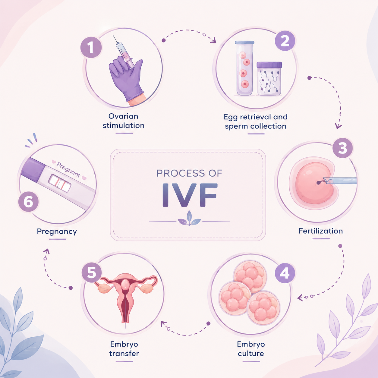 What is the step-by-step process of IVF treatment?